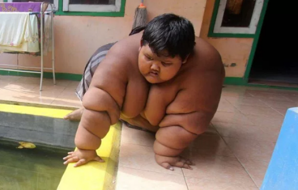 El niño más obeso del mundo se somete a una dieta para seguir viviendo