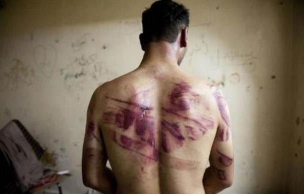 Secuestros, torturas y asesinatos...así se vive en las áreas sirias bajo control de los grupos rebeldes