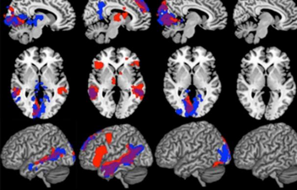 Resonancias magnéticas de distintos cerebros (MIT)