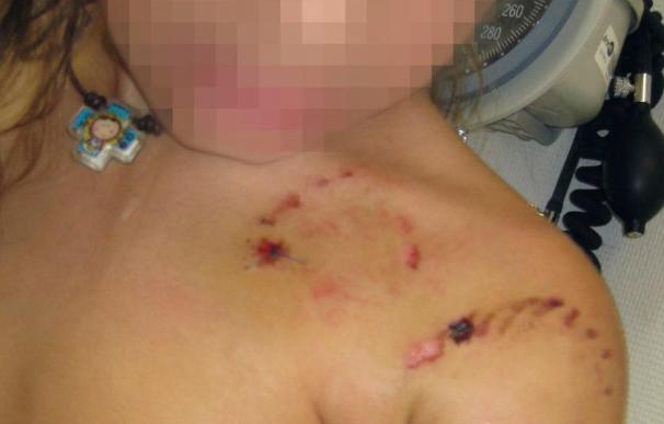 Una niña de seis años herida tras ser atacada por un pitbull