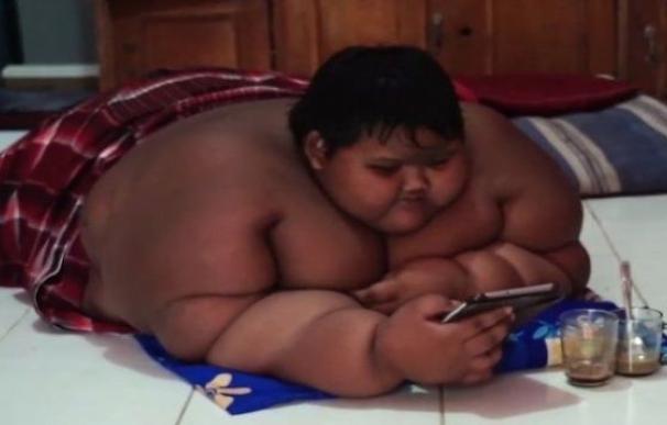 Arya Permana, el niño de diez años más gordo del mundo