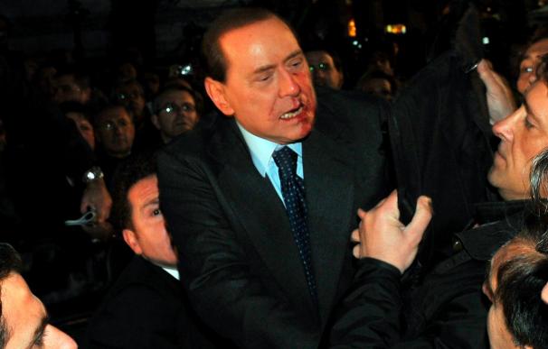 Berlusconi, operado en la cara por las secuelas de la agresión en Milán