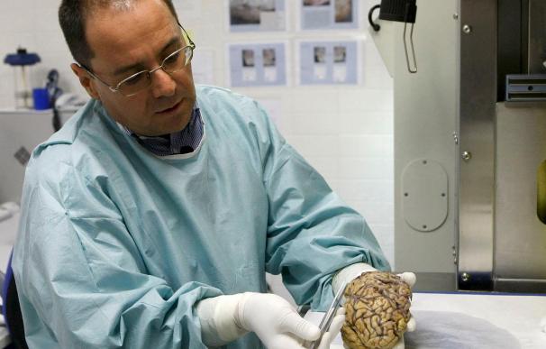 La donación de cerebros, imprescindible para entender el alzhéimer