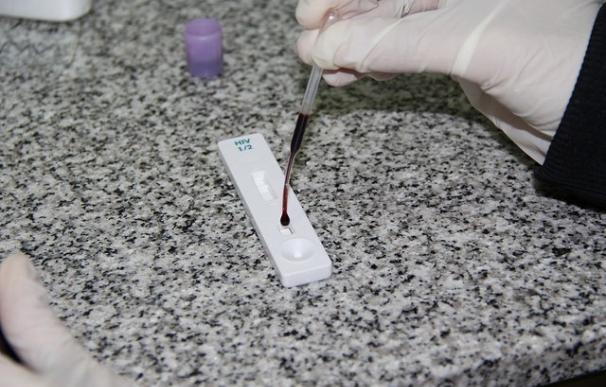 Cerca del 50% de los pacientes con VIH no se ha hecho el test para detectarlo por creer que no están en riesgo