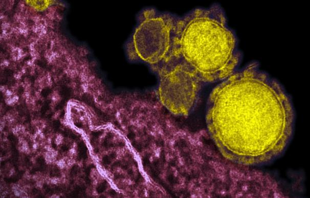 Primera evidencia de que el coronavirus puede causar enfermedades neurológicas