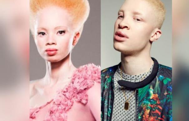 Un concurso de belleza de albinos para luchar contra los prejuicios en Kenia