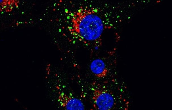 Investigadores descubren que el cannabinoide es capaz de matar las células tumorales gracias al 'reciclaje celular'