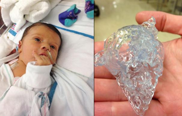 El bebé llamado S. tras la operación que fue preparada con una réplica en 3D de su corazón