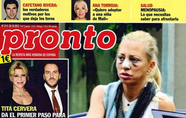 La operación estética de Belén Esteban acapara las portadas de las revistas del lunes