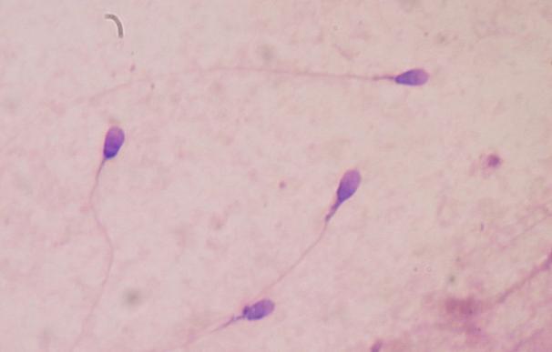 La proteína que cubre el esperma puede ser clave para la infertilidad masculina