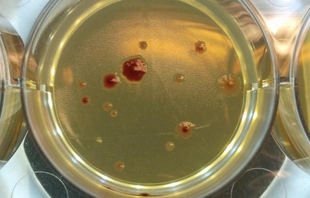 La resistencia a los antibióticos aumenta en los microbios "solitarios" mutantes