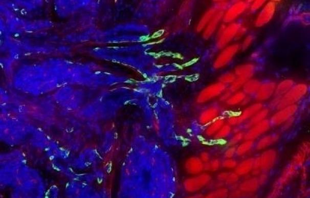 Investigadores determinan la estructura de lucha contra tumores de proteínas mutadas del cáncer de mama