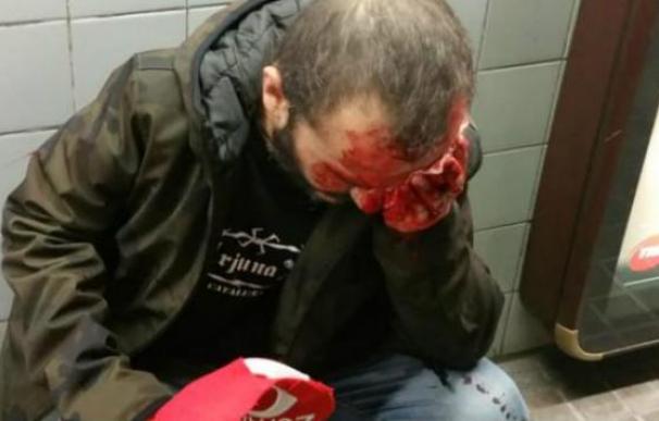 El hombre agredido en el metro de Barcelona tras la manifestación de Jusapol (Twitter)