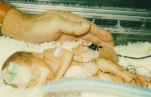 Tammy Lewis nació antes de tiempo y fue la bebé prematura más pequeña de Texas (Foto: CNN)