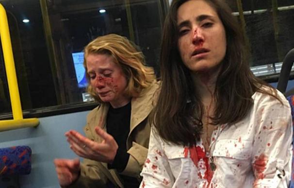 Melania Geymonat (d.) y su novia, tras la agresión que sufrieron en un autobús de Londres el 30 de mayo. /Facebook