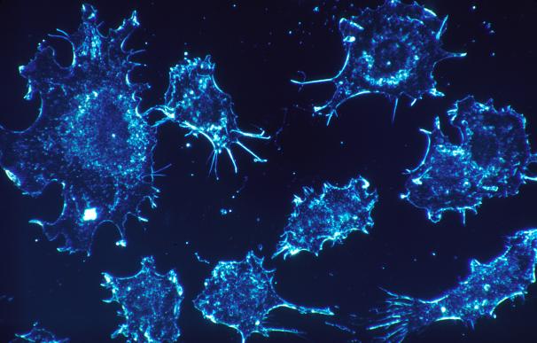 Fotografía de células del cáncer.