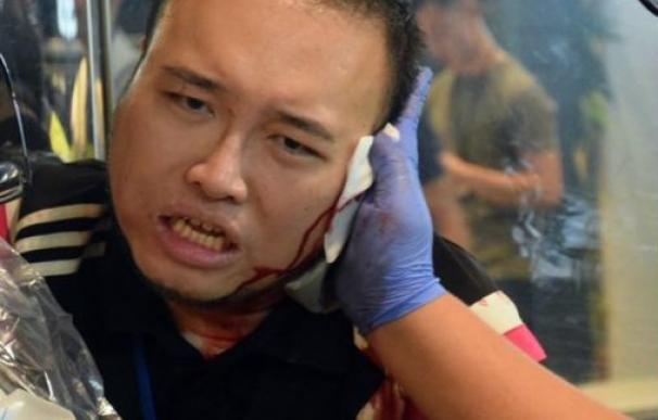 Andrew Chiu tras el ataque. /Foto: inmediahk.net.