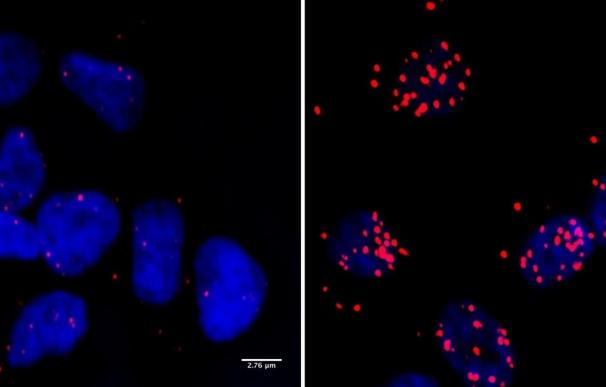 Células de un neuroblastoma: los puntos rojos marcan los sitios donde la proteína BRCA1 ocurre en contacto cercano con la ARN polimerasa II.
