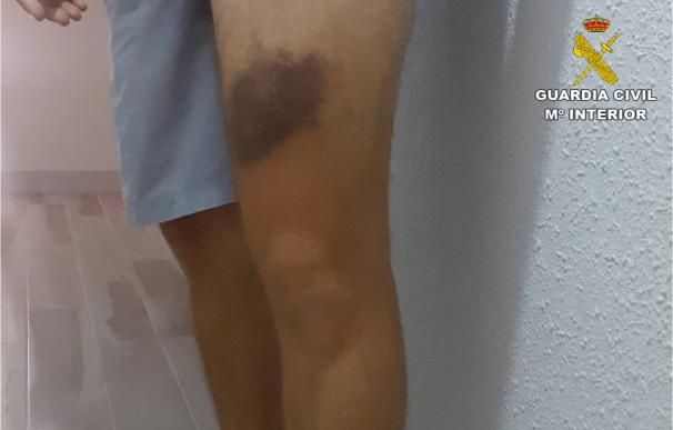 Lesiones sufridas por un agente de la Guardia Civil en Pego