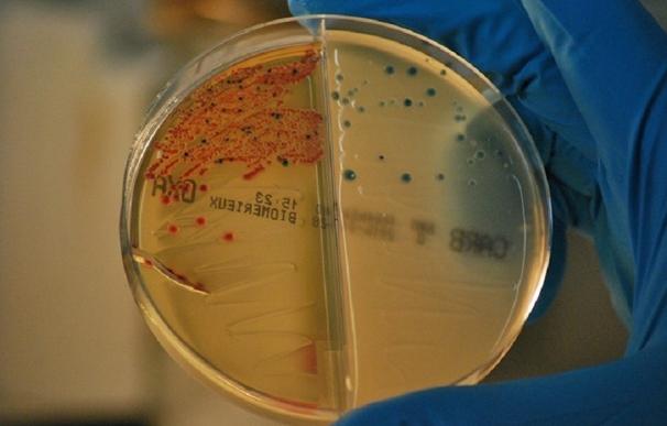 Bacterias resistentes a los antibióticos aisladas en el IRYCIS. /
JERÓNIMO RODRÍGUEZ BELTRÁN
(Foto de ARCHIVO)
29/1/2021