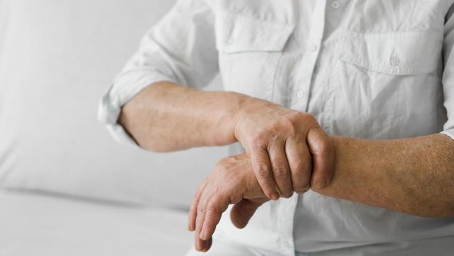 La artritis reumatoide es la más común de todas.